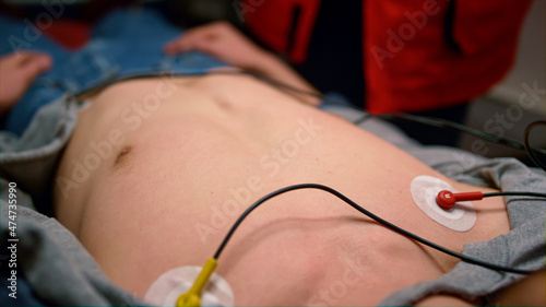 Closeup paramedic hands putting holter electrodes on man body