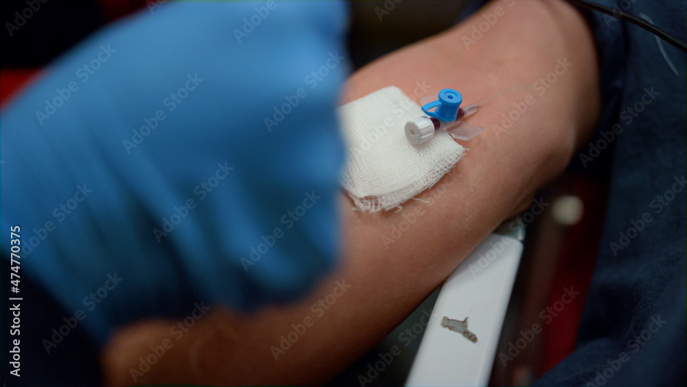 Paramedic inserting needle cannula in arm. Worker placing IV catheter into vein Paramedic inserting needle cannula in arm. Worker placing IV catheter into vein