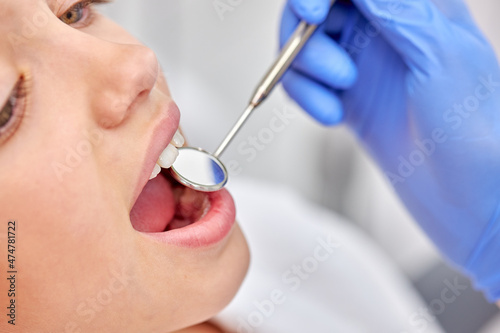 Charming caucasian child girl is examined by dentist in dental clinic. Healthy teeth and medicine concept.Close-up photo of child s face  sits on couch during checkup  before treatment