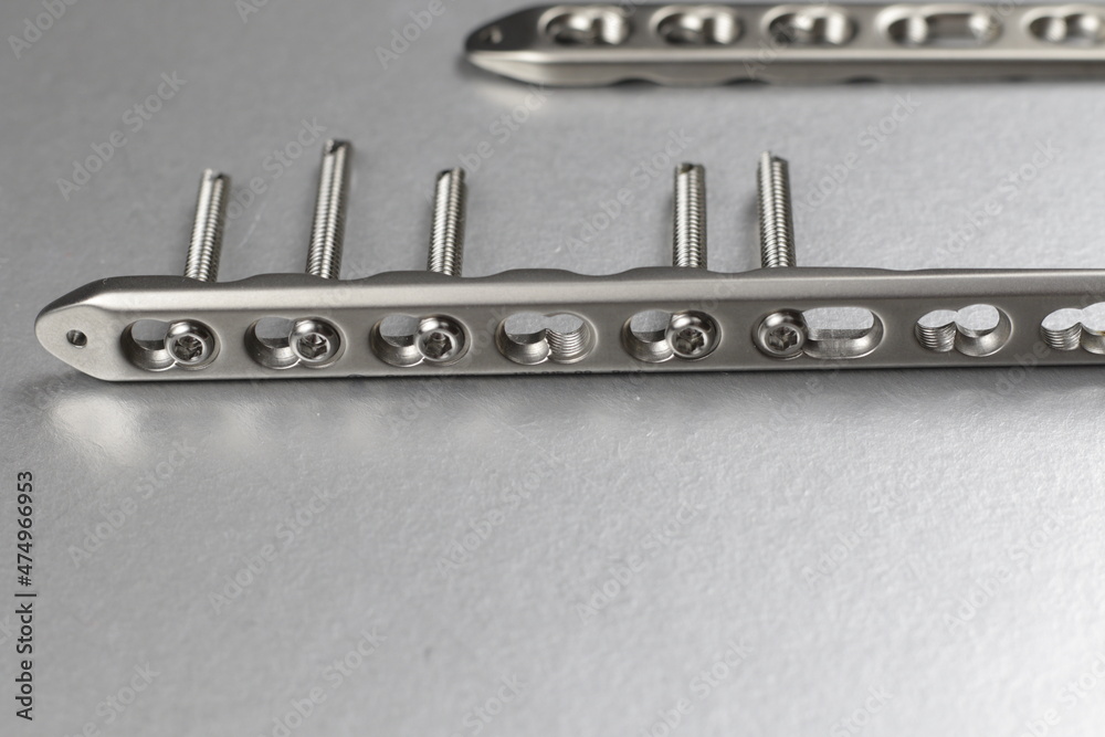 Surgical instruments in treatment of bone fractures Surgical instruments in treatment of bone fractures