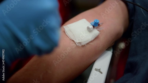 Paramedic inserting needle cannula in arm. Worker placing IV catheter into vein 