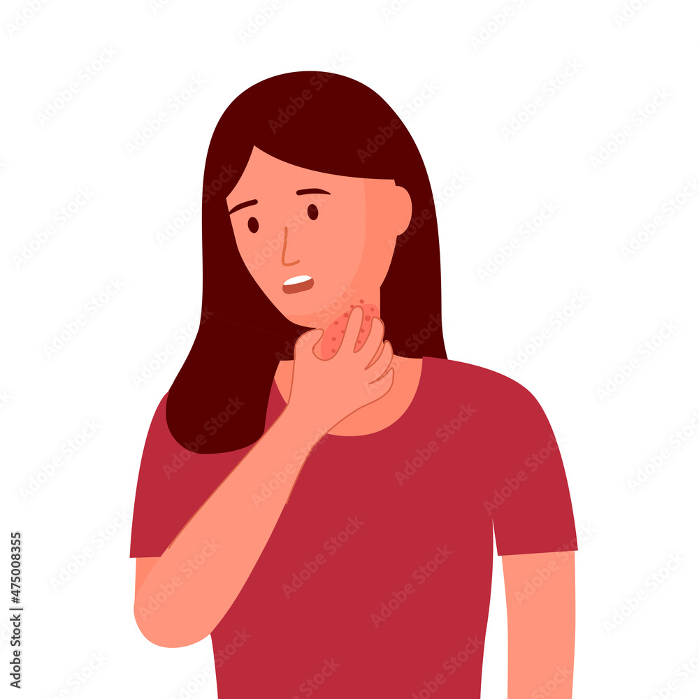 Young woman scratching her neck. Female suffering from strong allergy skin itchy symptom in flat design. Red rash skin irritation. Young woman scratching her neck. Female suffering from strong allergy skin itchy symptom in flat design. Red rash skin irritation.