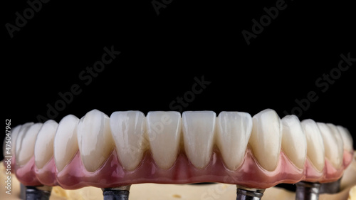 dentures on a black background, dental implants	
 photo