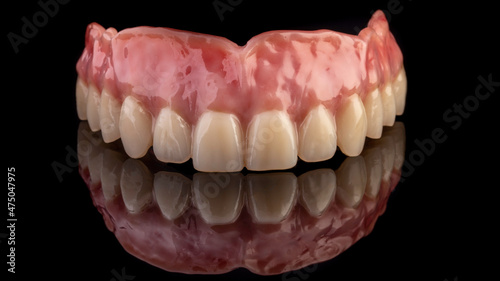 dentures on a black background, dental implants	
