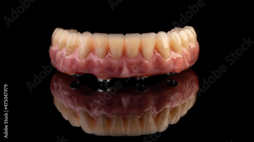 dentures on a black background, dental implants	
