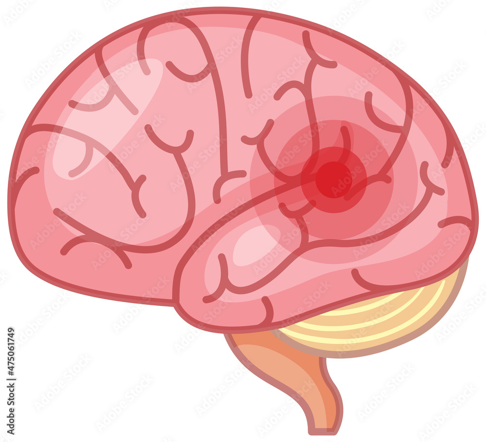 Fototapeta premium The brain has a red signal on white background