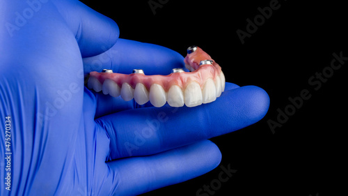 Dental implants and dentures in close-up Siemke on a black background	
