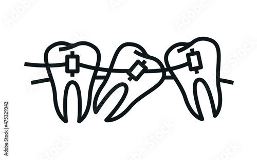braces icon, orthodontic teeth icons. Vector design.
