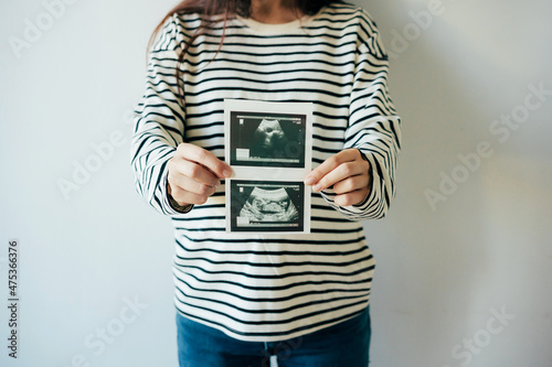 A woman in anticipation of the birth of a child holds an ultrasound scan in front of her.