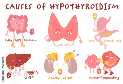 Causes of hypothyroidism thyroid gland disease. Endocrine system disorder. Medical vector illustration in cartoon style photo