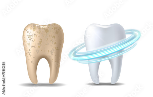 Clean and dirty tooth before and after whitening