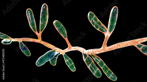 Microscopic fungi Epidermophyton floccosum, scientific illustration photo