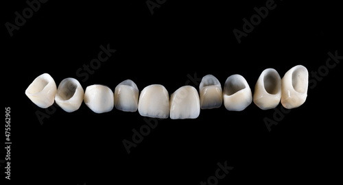 natural look press ceramic crowns