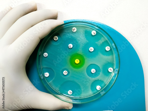 Antimicrobial susceptibility testing in culture plate. Drug sensitivity test, disk drug, antibiotic sensitivity. All basic usable antibiotic are sensitive except Ceftazidime and Cefradine. photo