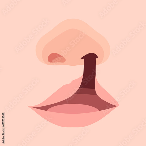 口唇口蓋裂_片側性唇顎口蓋裂のイラスト_アップ