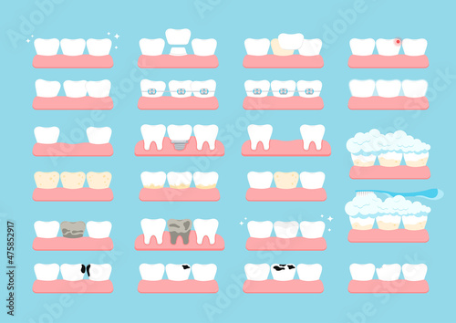 Tooth braces, implant, crooked and with tartar veneer in gum isolated on background. Healthy teeth and dental surgery prosthetics treatment concept. Flat cartoon vector dentistry clip art illustration