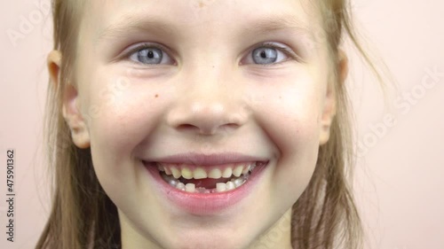 Close-up of the face of a little girl who shows her mouth with fallen milk teeth, grimaces.4k