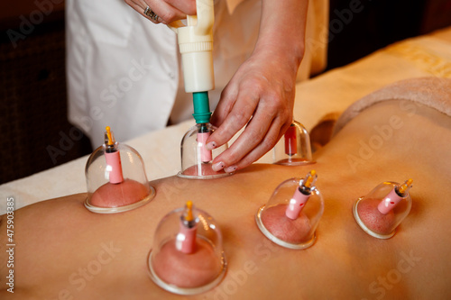 A young woman relaxes in a massage parlor. Vacuum cups of medical cupping therapy on woman back, close up, chinese medicine.