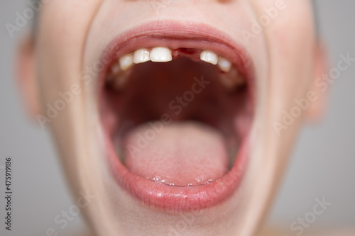 Fotografie, Obraz Close-up macro baby teeth