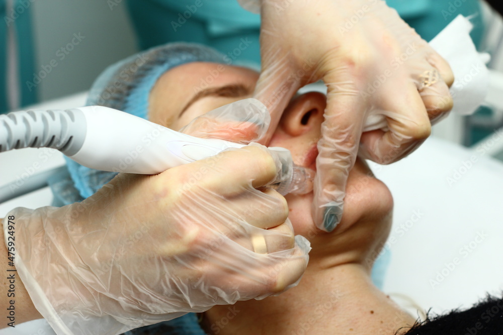Beauty salon. A cosmetologist in medical gloves and protective mask doing a hydra peeling procedure on the client's cheeks. Side view. Close up. Professional skin care during coronavirus pandemic. Beauty salon. A cosmetologist in medical gloves and protective mask doing a hydra peeling procedure on the client's cheeks. Side view. Close up. Professional skin care during coronavirus pandemic.