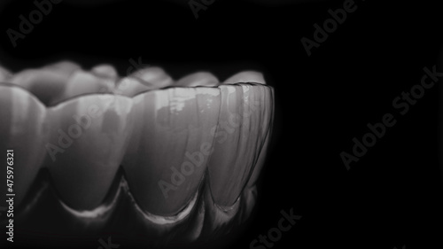 Dental implants and dentures in close-up Siemke on a black background	
