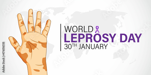 Wallpaper Mural world  leprosy day vector illustration