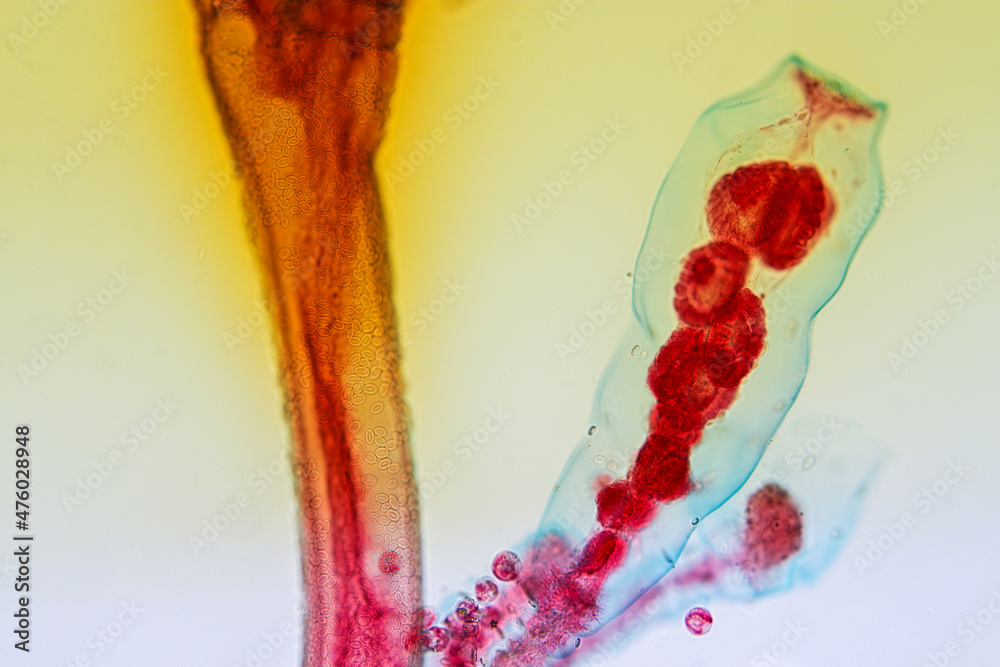 Hydra is a genus of small, fresh-water animals of the phylum Cnidaria ...