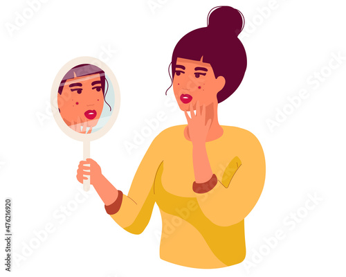 sad Young woman hand mirror worrying about her acne on face in flat design. Pimple problem on female skin. isolated on white