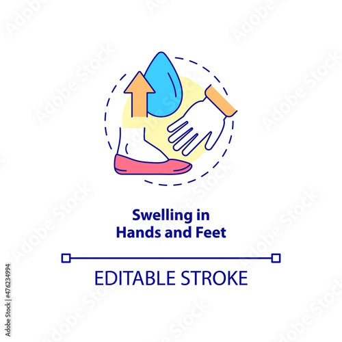 Swelling in hands and feet concept icon. Limbs enlargement. Edema abstract idea thin line illustration. Isolated outline drawing. Editable stroke. Roboto-Medium, Myriad Pro-Bold fonts used