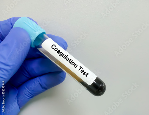 Φωτογραφία Blood sample for coagulation testing, PT, APTT