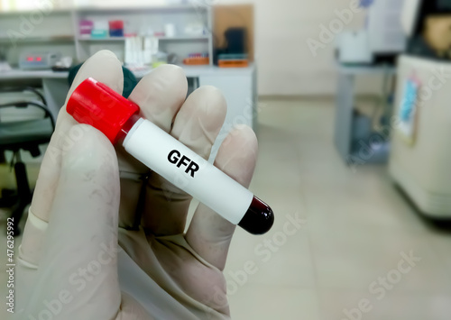 Glomerular Filtration Rate (GFR). Diagnosis of Renal or Kidney disease. BUN, Creatinine, eGFR photo