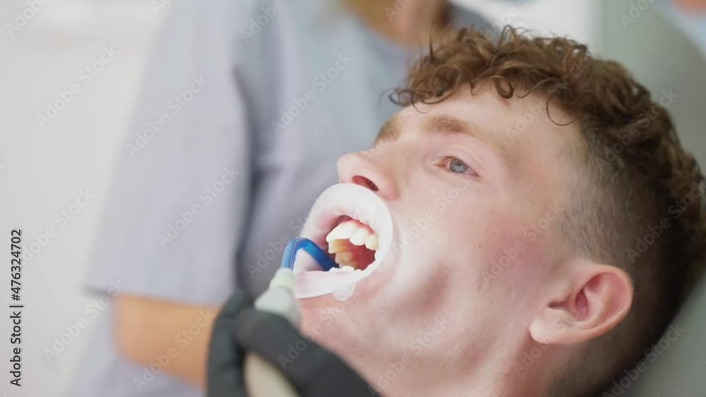 Stockvideo The dentist uses a special instrument to remove saliva from