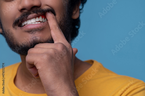 Adult man showing his periodontal disease before the camera photo