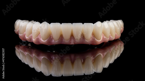 Dental implants and dentures in close-up Siemke on a black background	
