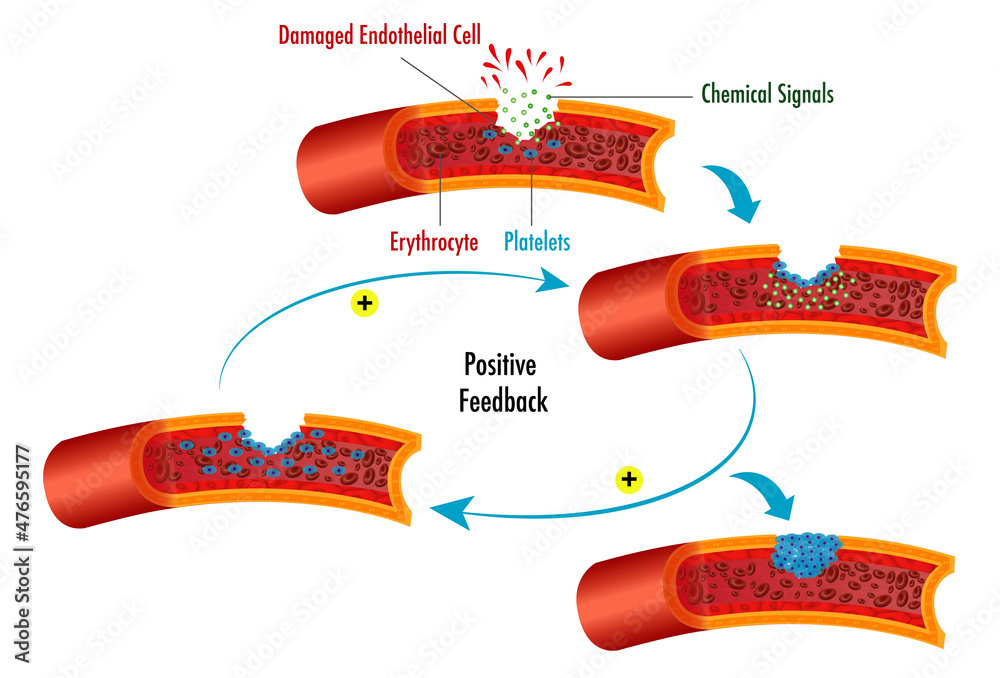 Venous Looping