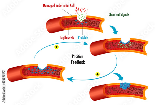 Positive feedback as illustrated by the clotting process in blood. Damaged endothelial cells. A type of epithelial cells.  photo