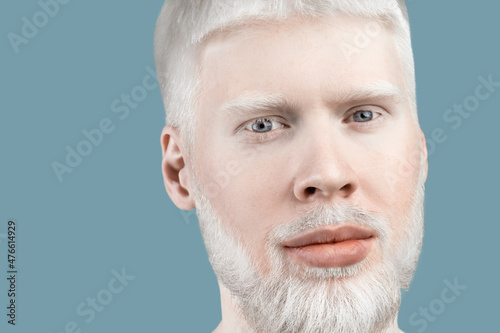 Albinism concept. Portrait of young bearded albino man with white hair, pale skin and blue eyes, turquoise background
