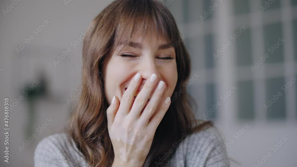 Cheerful young woman with vitiligo skin condition laughing on camera, emotions Cheerful young woman with vitiligo skin condition laughing on camera, emotions
