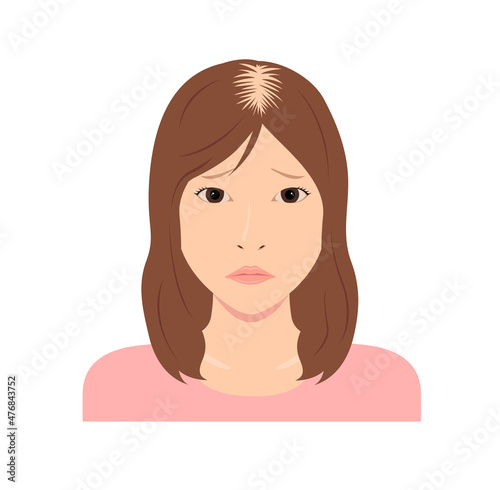 Female Androgenetic Alopecia vector illustration