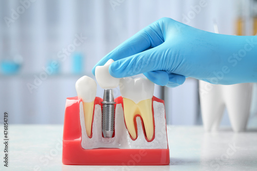 Dentist putting crown onto abutment of dental implant between teeth at table indoors, closeup photo