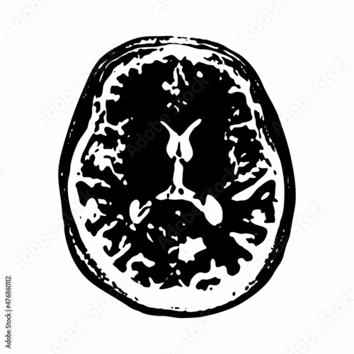 mri of the brain of an adult male on a white background.