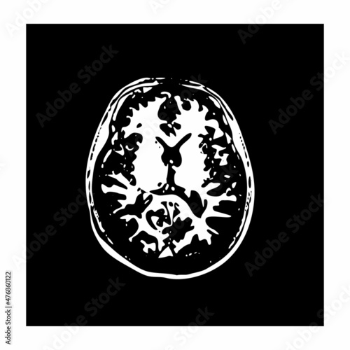 mri of the brain of an adult male on a black background.