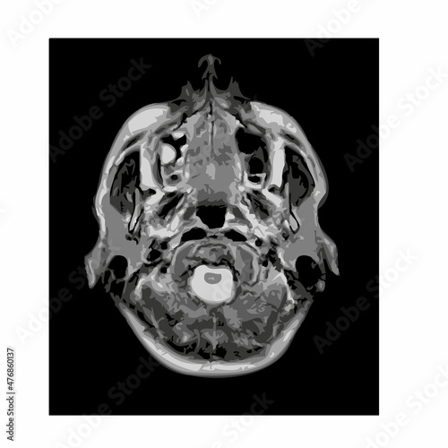 mri of the brain of an adult male on a black background.