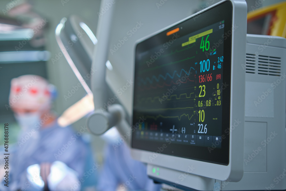 Heart rate and patient condition control monitor in hospital theater room during surgery operation Heart rate and patient condition control monitor in hospital theater room during surgery operation