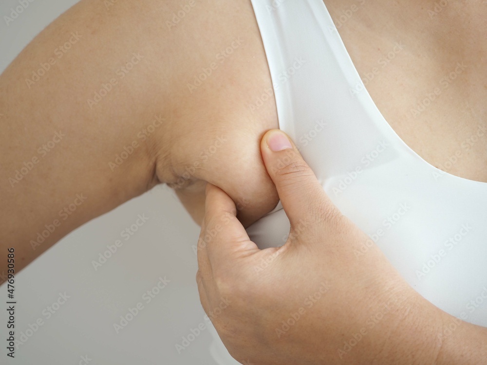Foto de Armpit fat at asian woman between 30-40 years old dressed in a  sporty bra. closeup photo, blurred. do Stock
