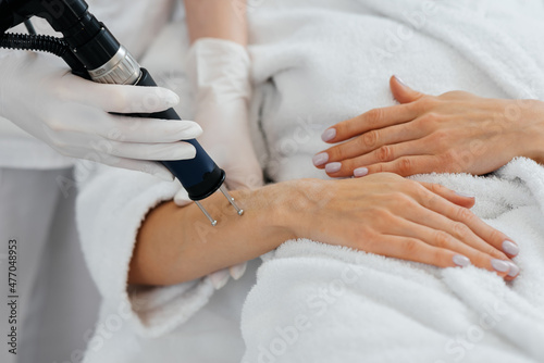 A young girl gets carbon peeling for the skin of her hands in a beauty salon. Laser pulses cleanse the skin. Hardware cosmetology. The process of photothermolysis  warming the skin.