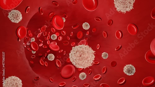 Metastasis, Cancer cell spreading through bloodstream