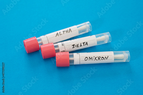 Swab tubes with medical samples on blue background