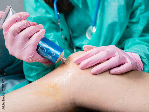 A doctor in medical gloves applies an anesthetic cream to a hematoma of a patient's knee in a clinic.