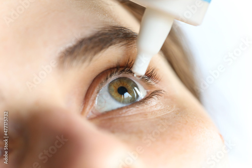 woman applying eye drop. Vitamin drops from tiredness and redness eyes. Suffering from irritated eye, optical symptoms. . High quality photo